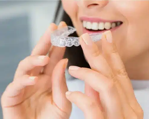 Invisalign clear retainers